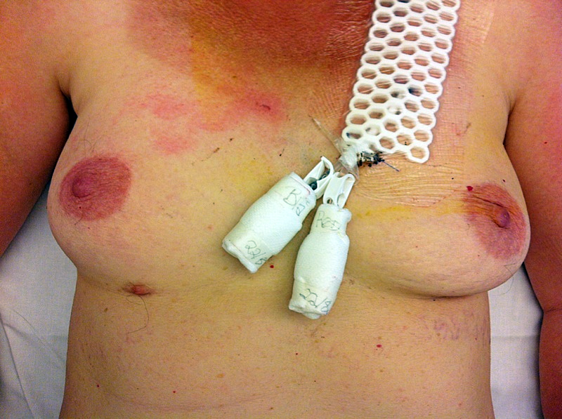 Aksessorisk-brystvorte1.png