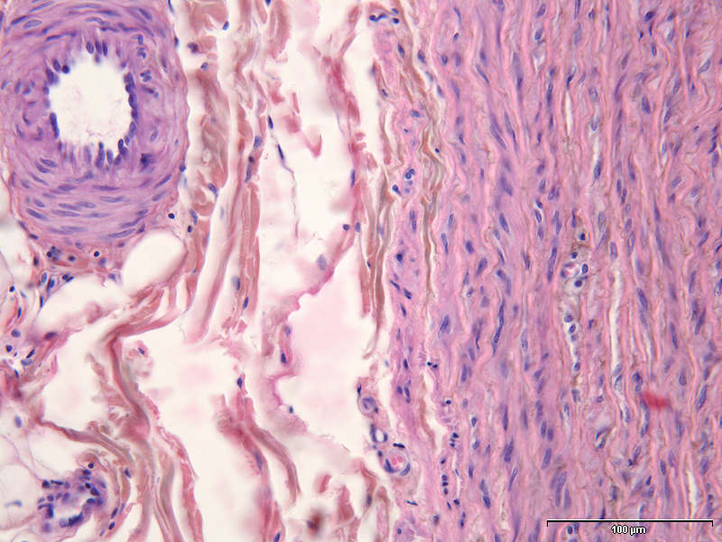 Histologi og patologi p nett - Det Medisinske Fakultet, UiO