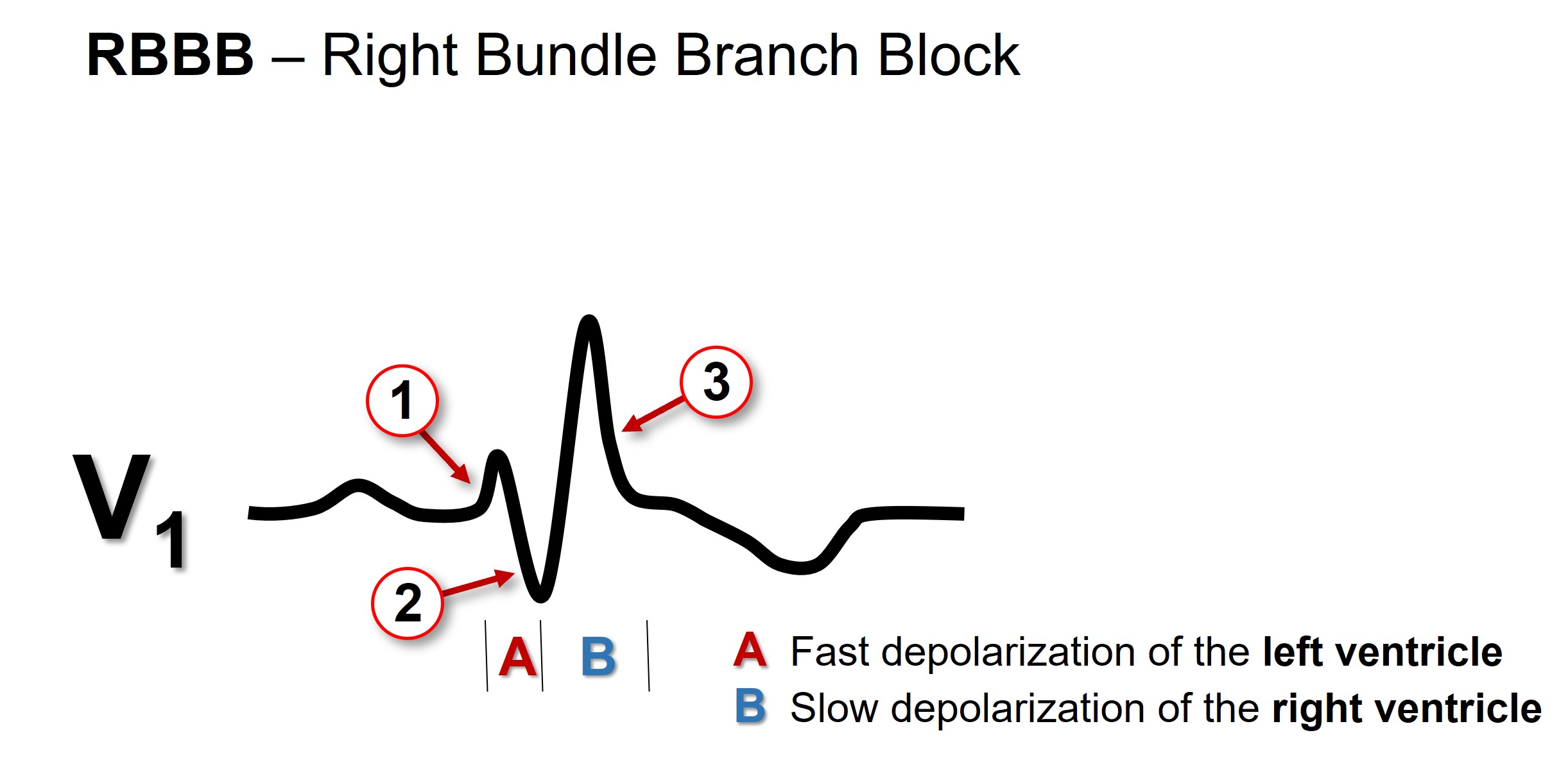 QRS width (duration)