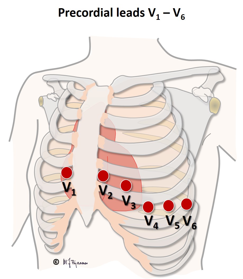 Precordial leads V1 - V6