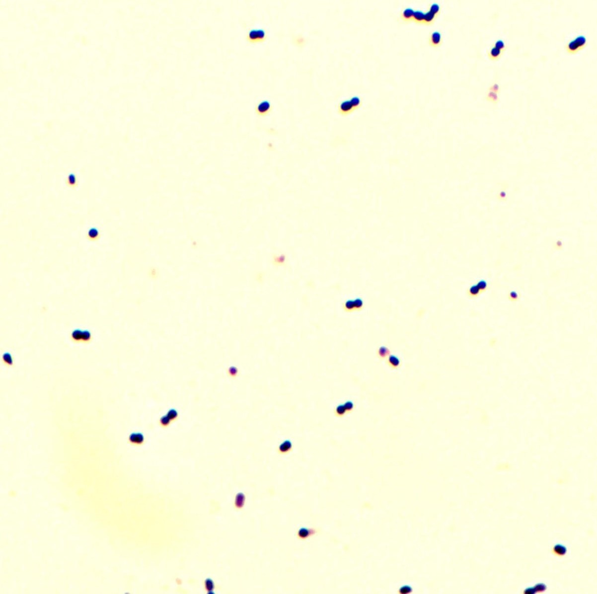 Mikroskopi_S.pneumoniae_100x