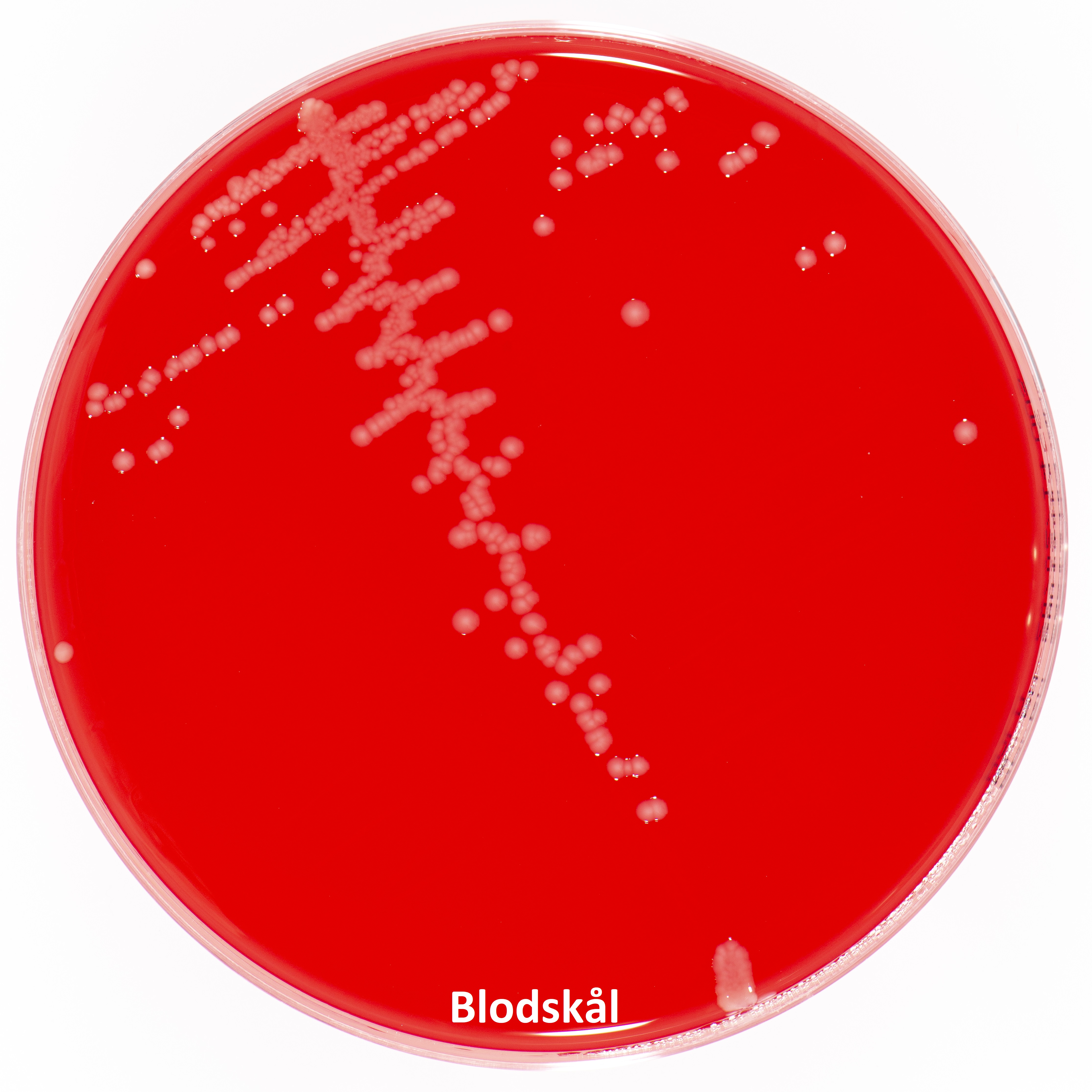E.coli_urin_blod
