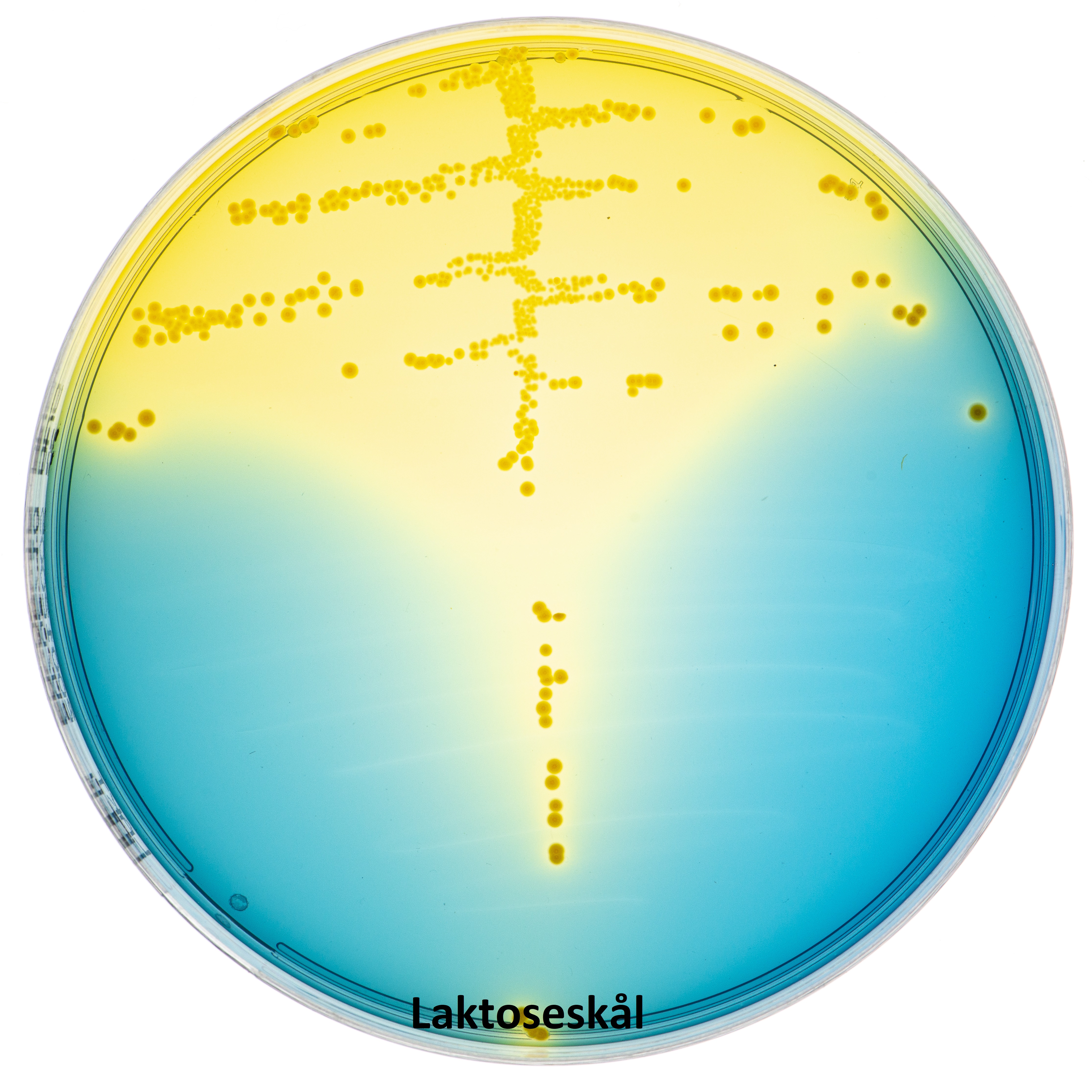 E.coli_urin_laktose
