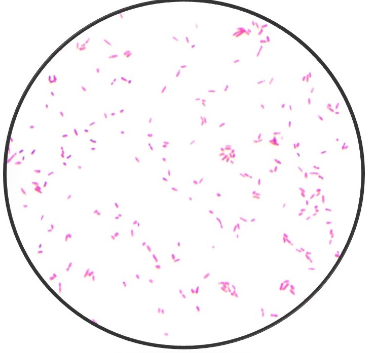 mikroskopi_blodkultur