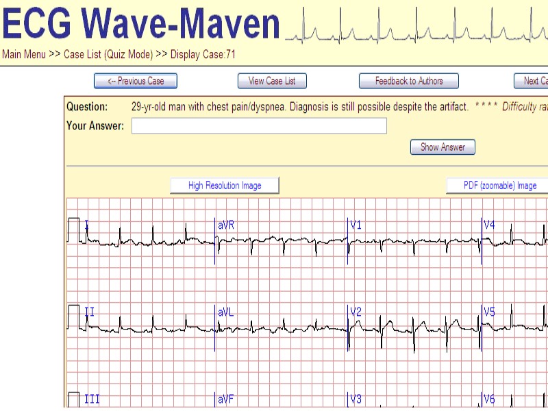 EKG wave maven