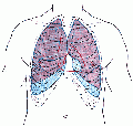 120px-Lungegrenser ventralt.gif