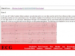 250px-EKG University of Wisconsin Madison .jpg