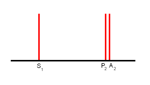 Fil:20141107105844!Revers splitting.PNG – JournalWiki