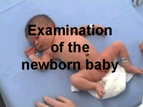 20141107105905!Ped-newborn.png