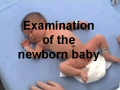 20141107105902!120px-Ped-newborn.png